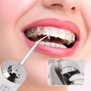 Pacchetto 1 + 1 Idropulsore Orale Professionale per Doccia Orale - Pulizia Dentale Avanzata in 30 Secondi